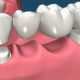 دندانپزشکی دکتر اشکان مبینی